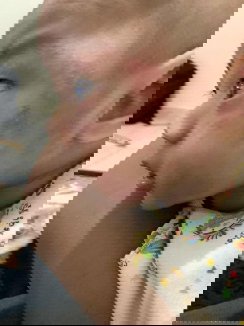 Semacam Alergi gatal2