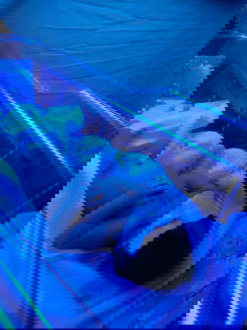 ลูกตัวเหลือง ต้องอยุ่ไฟ จะทำยังไงดีคะ?