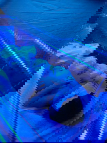 ลูกตัวเหลือง ต้องอยุ่ไฟ จะทำยังไงดีคะ?