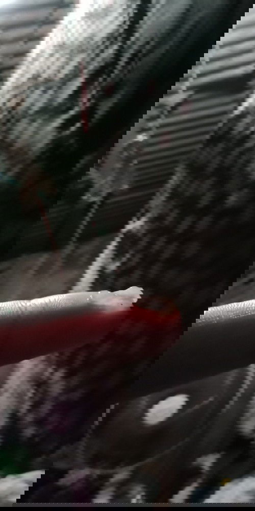 มีแม่ๆท่านไหนมีแบบนี้ไหมค้ะมันคืออะไรหรอค้ะ#แม่ๆท่านไหนรู้ช่วยบอกหน่อยนะค้ะตอนนี้กังวลมค้ะ(38w+5d)