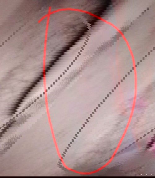 Worried future Mom🥺Warts or not?