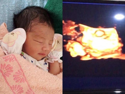 #พี่กับน้อง แม่ๆว่าเหมือนกันไหมคะ😻 ตอนนี้พี่4ขวบ ในท้อง8เดือน