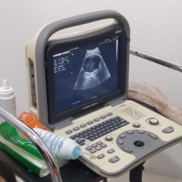 34 WEEK BBJ janin 2.1 bunda yang lain 34 WEEK BBJ brpa?