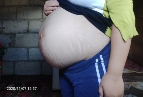 Mag 33 weeks napo π
