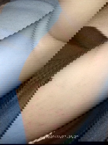 Bun, kira² kalo si kecil muncul bintik² merah kya gini👇gmna ya cara nanganin, nya.. Mohon sarannya