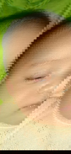 Mau tanya nih bun.. yang merah di kelopak mata anak saya itu apa ya? Bisa sembuh ga ya?