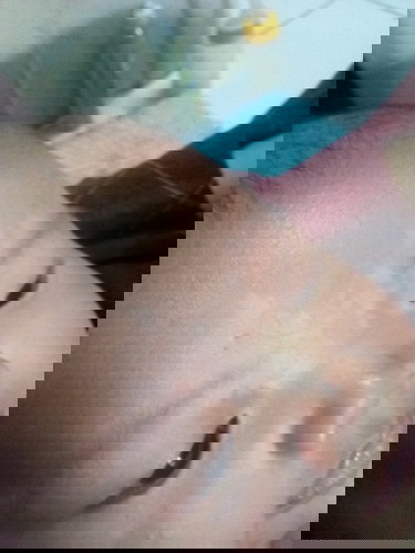 bun ada yang tahu ini kenapa ya ? terus obatinnya gimana ?
baby3mounth