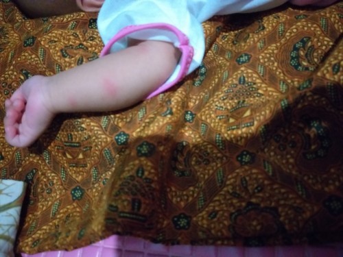 Kira2 apa y bun obatnya biar ilang ini bukan gigitan nyamuk atau serangga tapi gk tau pd kluar sndr