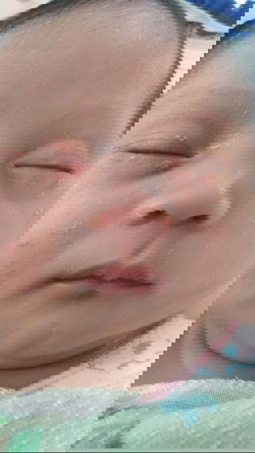 Alergi atau hanya ganti kulit