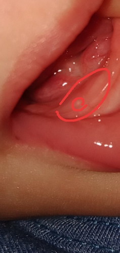 Teething po ba baby ko?