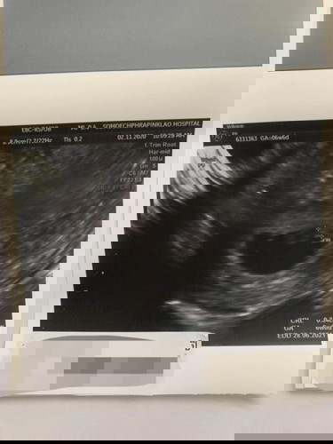 อายุครรภ์ประมาณ 7 สัปดาห์แล้วครับ สอบถามครับ ภรรยาผมมีอาการปวดท้องน้อยแถวๆมดลูกจะมีปัญหาอะไรมั้ยครับ