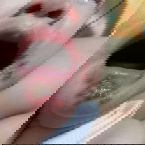 แบบนี้นานมั้ยคะกว่าจะหาย