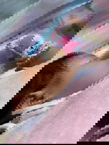 แม่ๆคนไหนให้ลูกกินนมผงแร้วผื่นขึ้นแบบนี้บ้างค่ะ?! #อันตรายไม