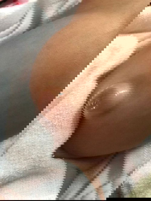 สะดือปูดออกมา