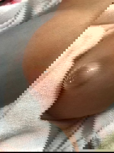 สะดือปูดออกมา