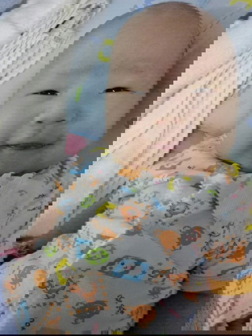 อัพเดตอาการน้องติดเชื้อไวรัสRSV