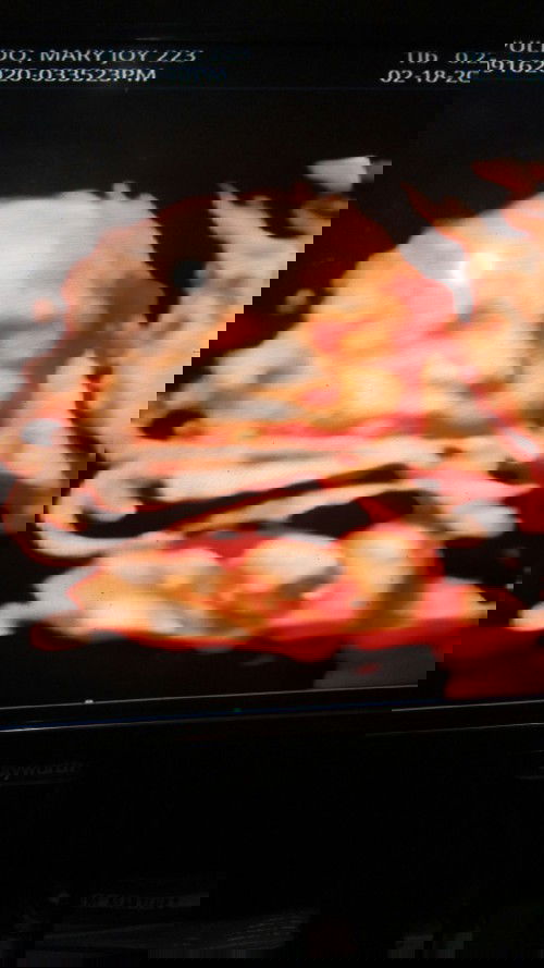 38weeks inconsistent labor pains