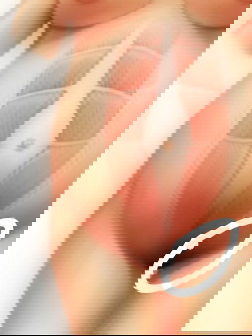 อายุครรภ์​24w2d