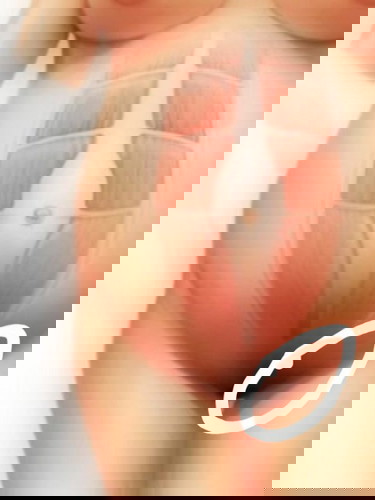 อายุครรภ์24w2d