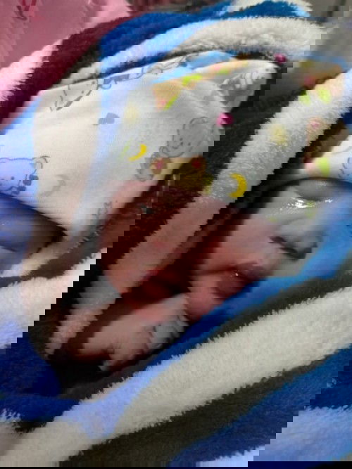 ประสบการณ์ การคลอด😂 39+5