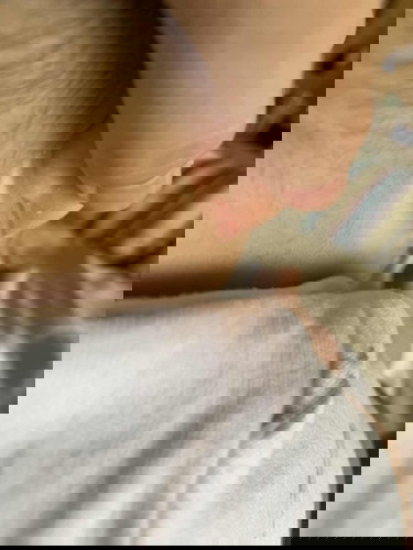 แผลค่ะ