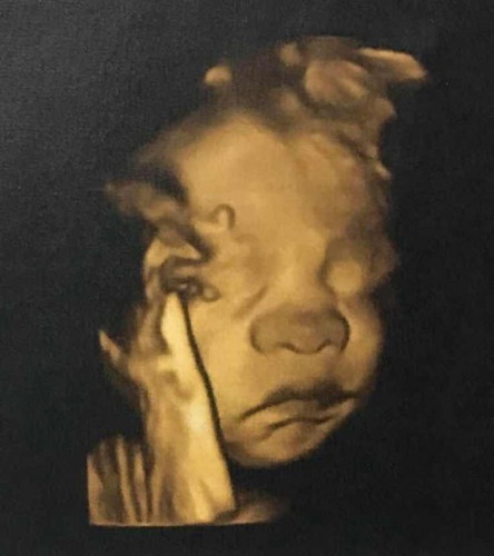 ลูกชายสุดที่รัก 👶🏻💕