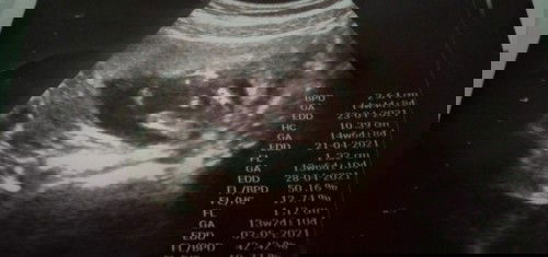 ทีม เมษา 64