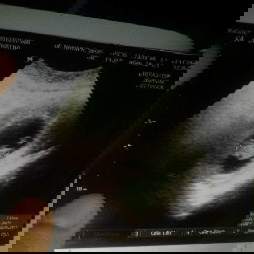 Hallo bunda2
Ada gak ya yg seperti nasib saya ?