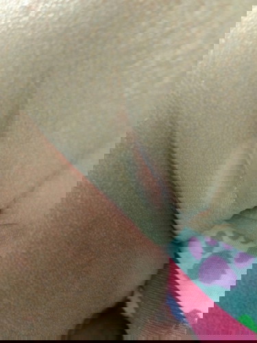 lipatan d leher bayi