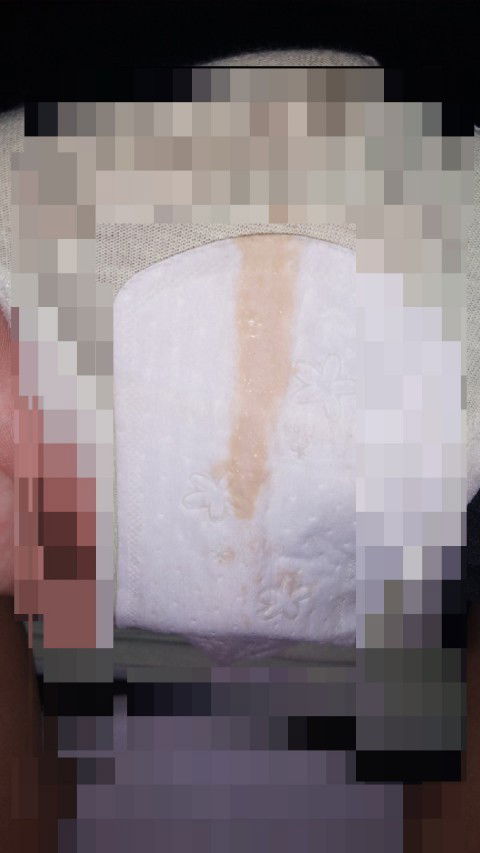 แบบนี้ใช่มูกเลือดไหมค่ะ