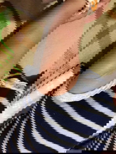 Digigit nyamuk