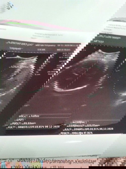 37w belom masuk panggul