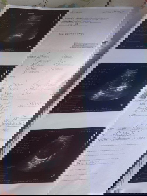 เเบบนี้ถือว่าน้องปกติไหมค้าเเม่ๆกลับหัวเเล้วค้ะ