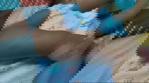 Bintik2 Merah Di Tangan