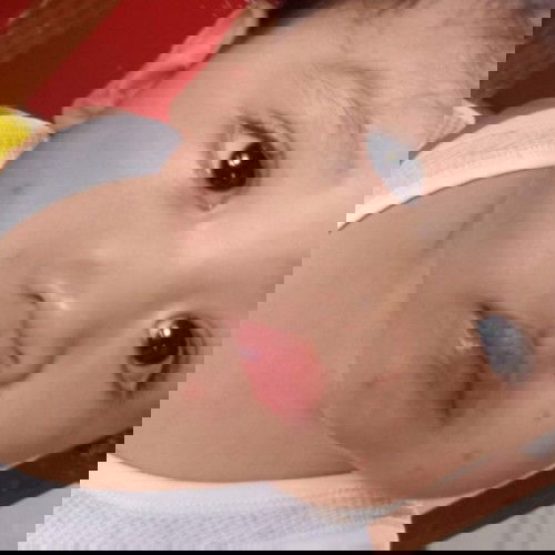 Red spot sa mukha ni baby