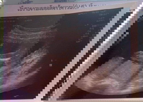 ช่วยดูหน่อยจ้า ช หรือ ญ