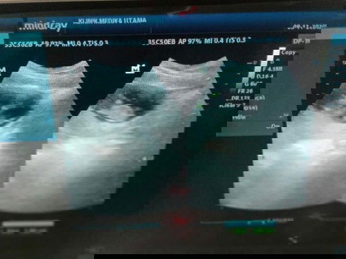 minta sarannya dong bun