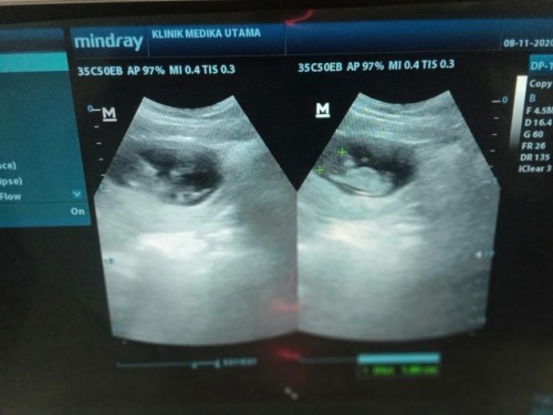 minta sarannya dong bun