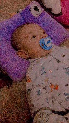 Bayi Mengempeng