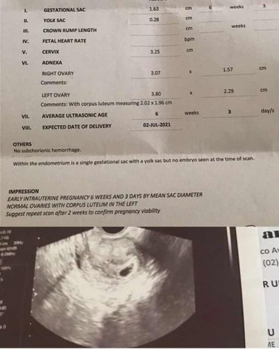 TRANSV ULTRASOUND , NO EMBRYO