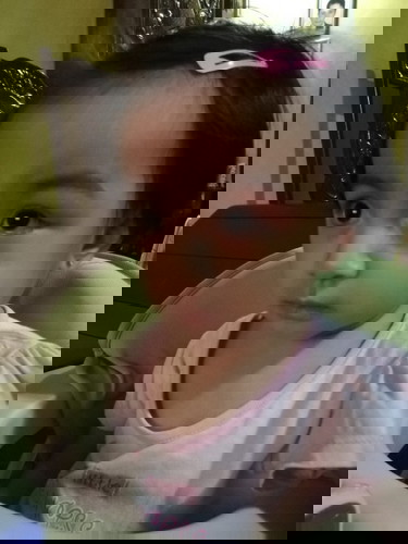 Cockroach bite treatment