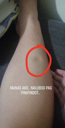 Manas na binti