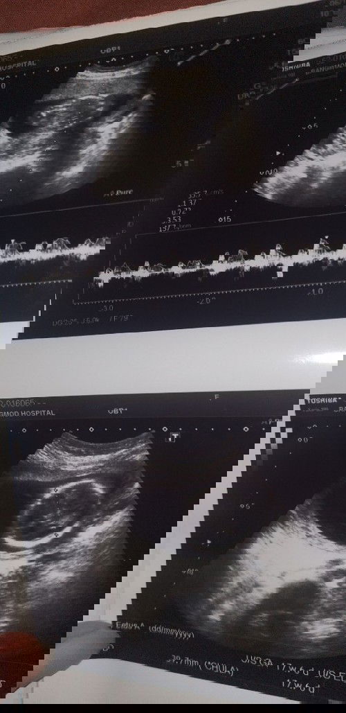 มองไม่ออกเลย