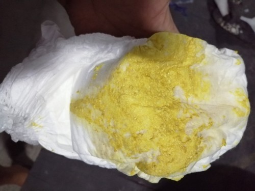 ลูกอึสีแบบนี้ปกติไหม