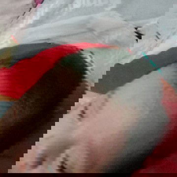 timbul bintik-bintik merah pada kulit