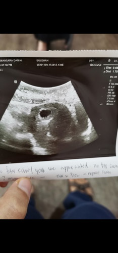 Kalau ikut tarikh period, patut minggu ni da 8w..tp scan mcm 5-6w..normal ke? Mcm jauh sgt je gap😅