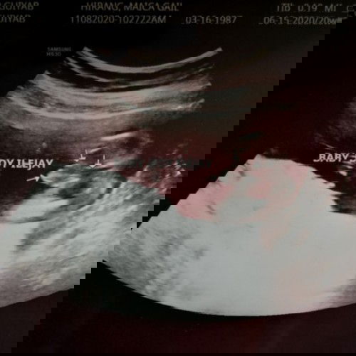 We're having a boy! 👶💕