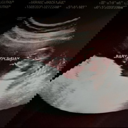 We're having a boy! 👶💕