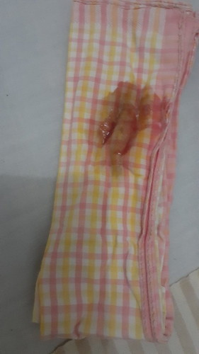 May lumalabas na kulay brown na dugo sa pwerta ko