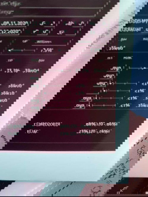 Suspect IUGR, menakutkan?